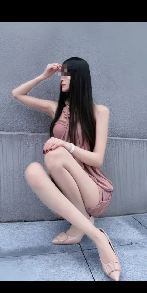 A379